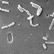 Pseudomonas aeruginosa under a SEM CDC Janice Haney Carr.jpg