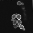 scopesFTR1ERG11 (2).png